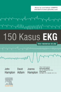 Image of 150 Kasus EKG