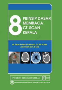 Image of 8 Prinsip Dasar Membaca CT-Scan Kepala