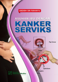 Image of Asuhan Ibu dengan Kanker Serviks