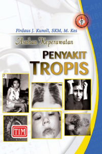 Image of Asuhan Keperawatan Penyakit Tropis