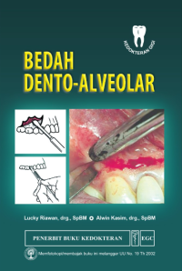 Image of Bedah Dento Alveolar