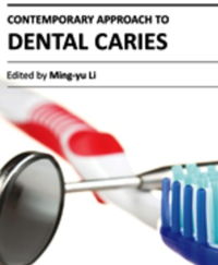 Image of Contemporary Approach To Dental Cariers