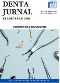 Image of Denta : Jurnal Kedokteran Gigi