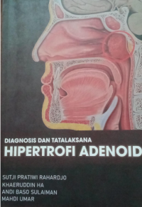 Image of Diagnosis dan Tatalaksana Hipertrofi Adenoid