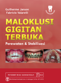 Image of Maloklusi Gigitan terbuka Perawatan & Stabilisasi