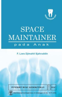 Image of Space maintainer Pada Anak