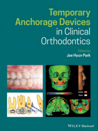 Image of Temporary Anchorage Devices in Clinical Orthodontics